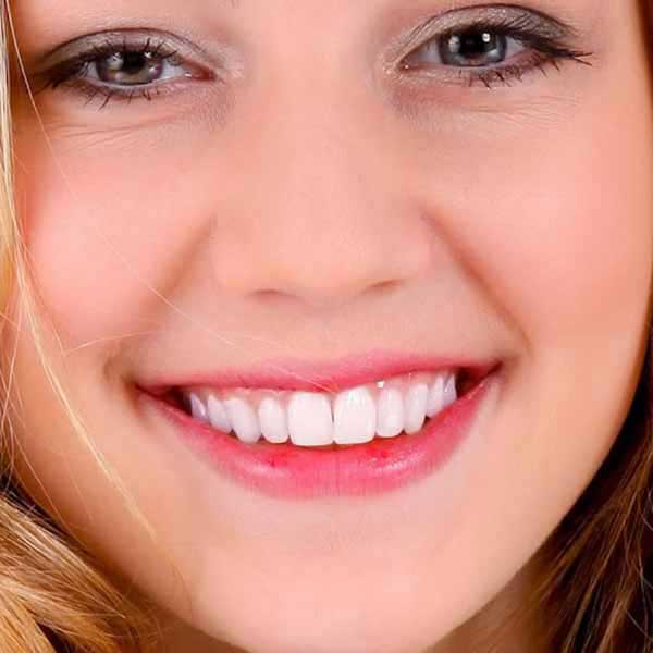 After Dental Treatment at Vidhaan Dental Clinic